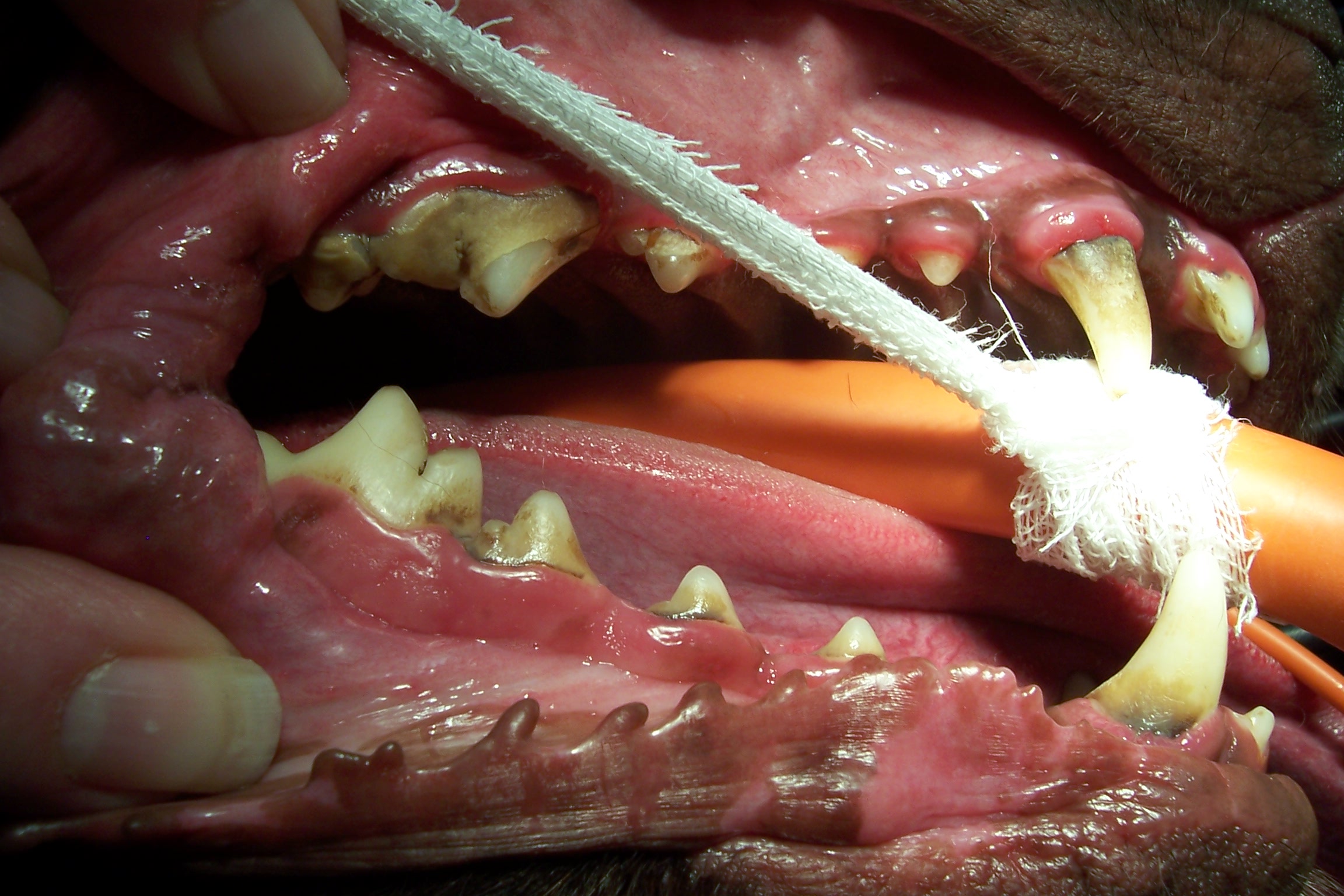 Before a dental cleaning