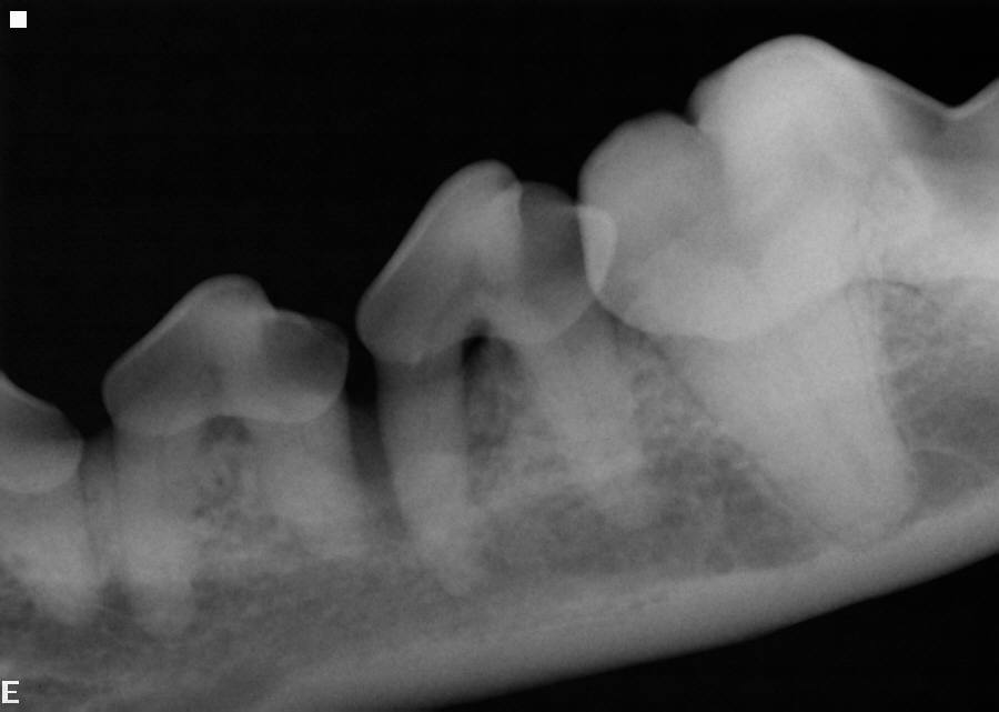 Digital dental X-ray — left mandibular