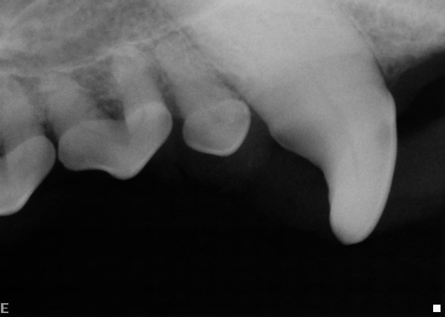 Digital dental X-ray — right bitewing